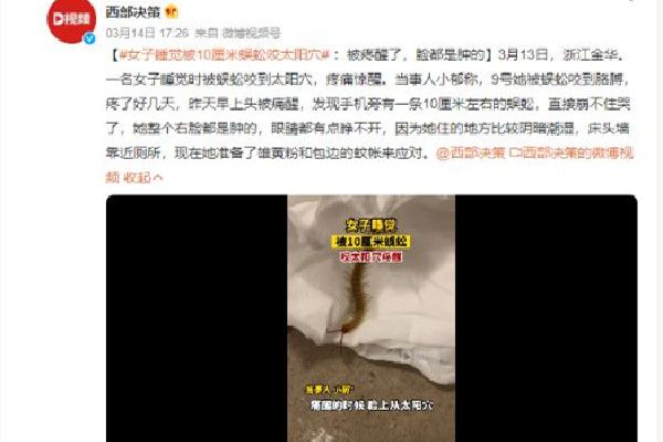 女子睡覺時被10厘米蜈蚣咬太陽穴 被蜈蚣咬了會有生命危險嗎 女子睡覺時被10厘米蜈蚣咬太陽穴 被蜈蚣咬了會有生命危險嗎